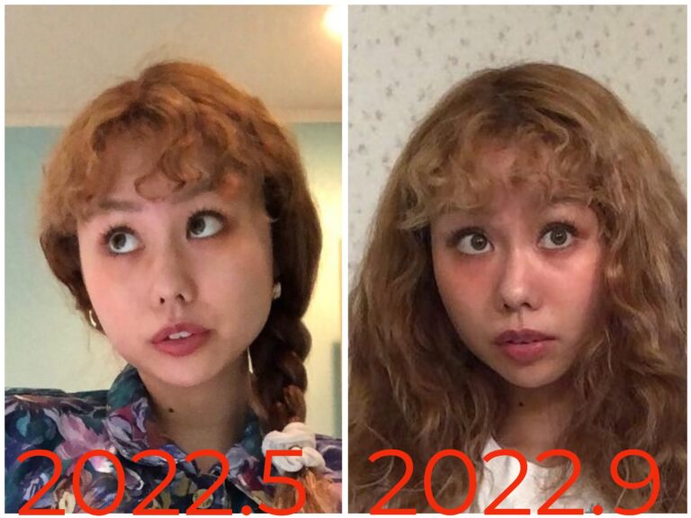 【画像比較】ぺこ離婚してやつれた?痩せた輪郭と目元が目立ち心配の声 | あこらべる